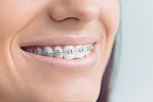 Best Dental Fillings (Composite and Amalgam)  in Houghton, NY